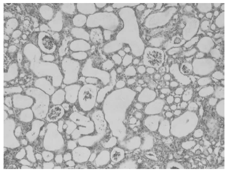 Serie Introduzione alle impurità attive del folato: ① Svelare l'impatto dell'acido 5-metiltetraidropteroico.